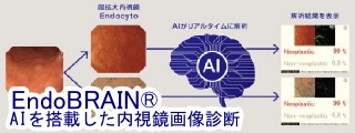 EndoBRAIN